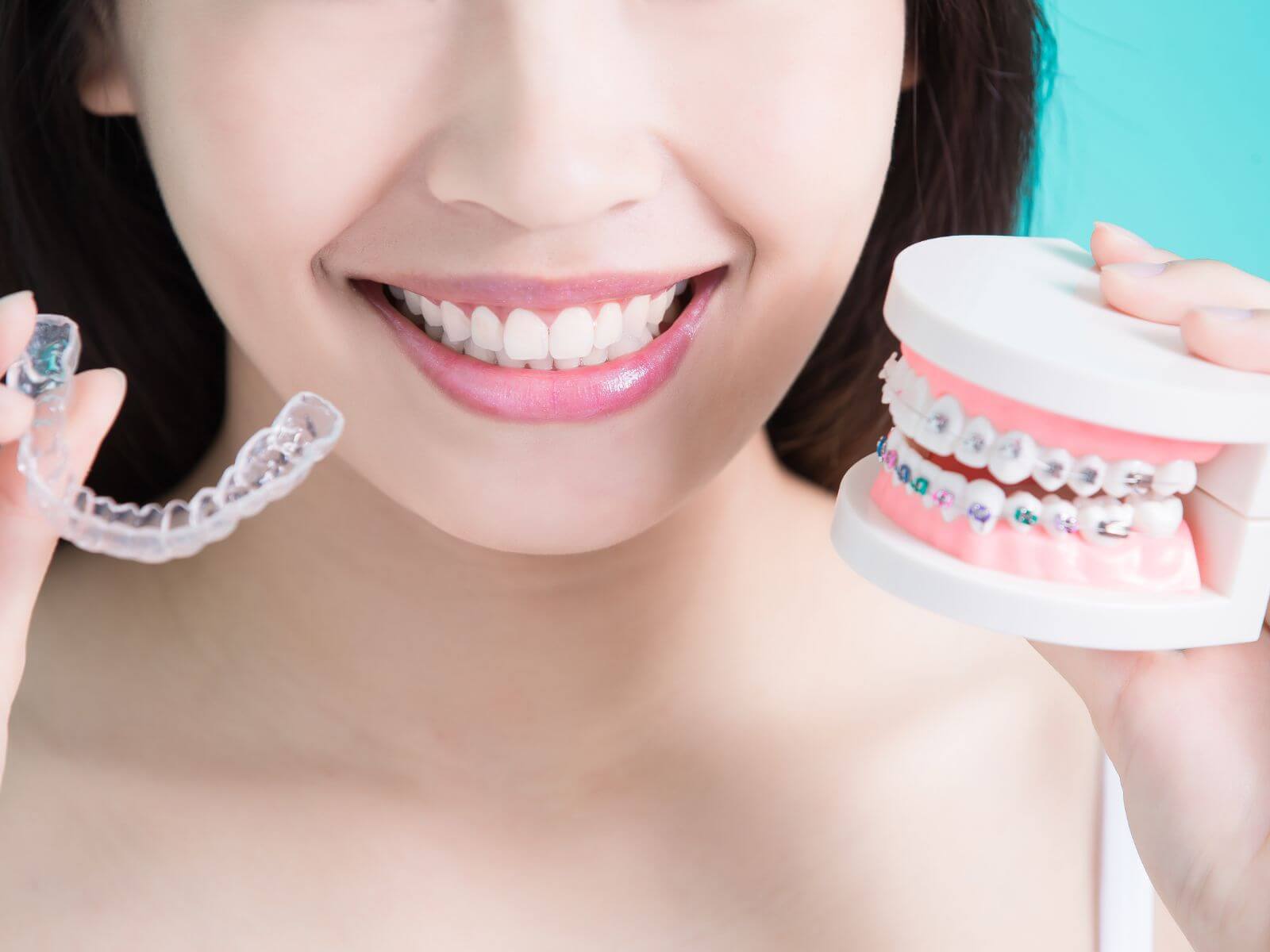 The Importance of Wearing Retainers After Invisalign Treatment