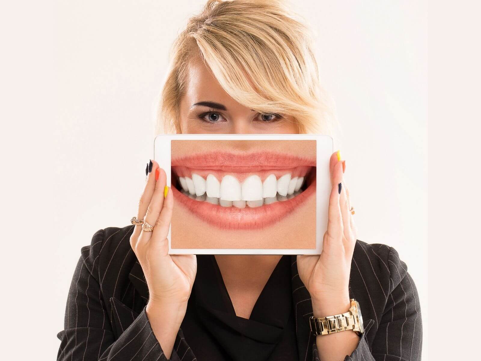 Can You Use Teeth Whitening on Dentures?