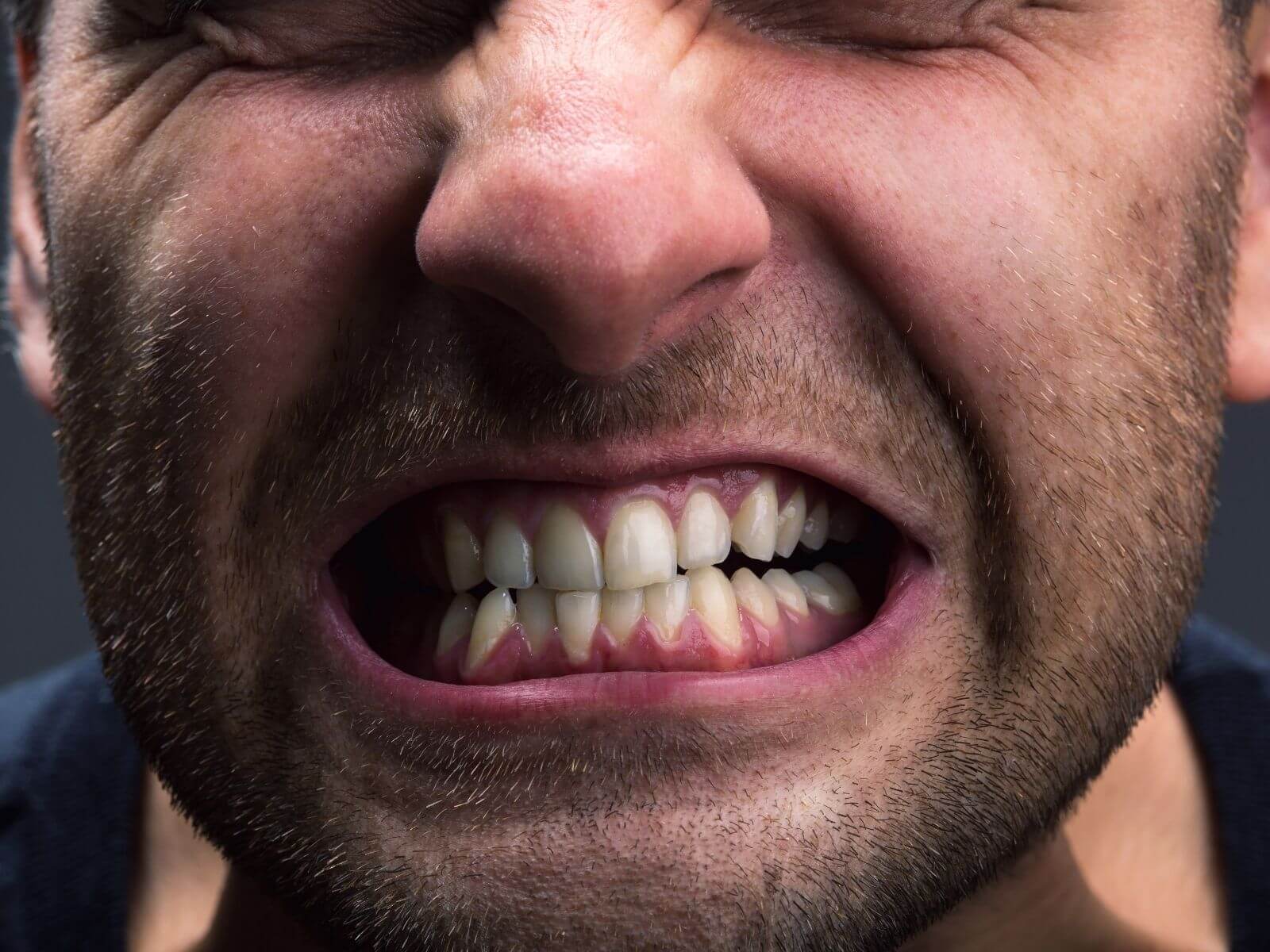 Natural Ways To Prevent Bruxism And Teeth Grinding